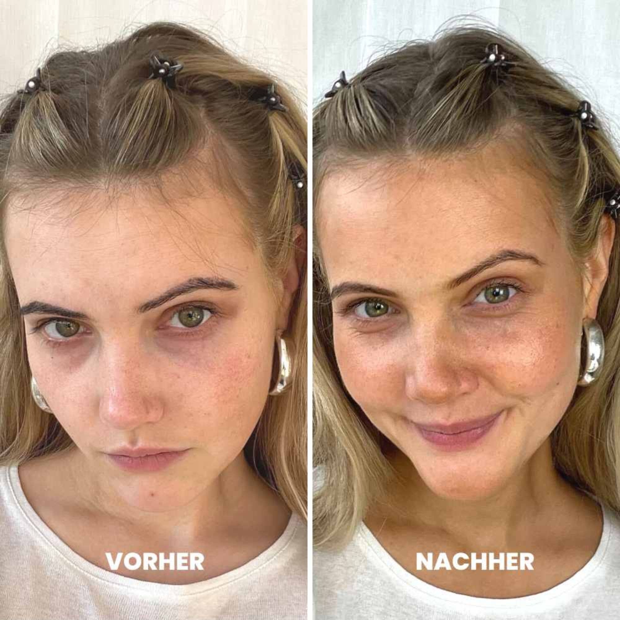 Anti-age | Brun-utan-sol-droppar för ansiktet – 30 ml