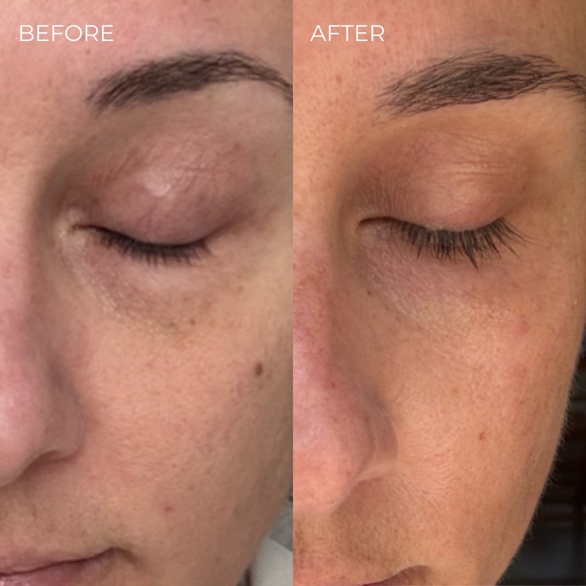 BEAUTICAL | Eyelash Enhancing Serum