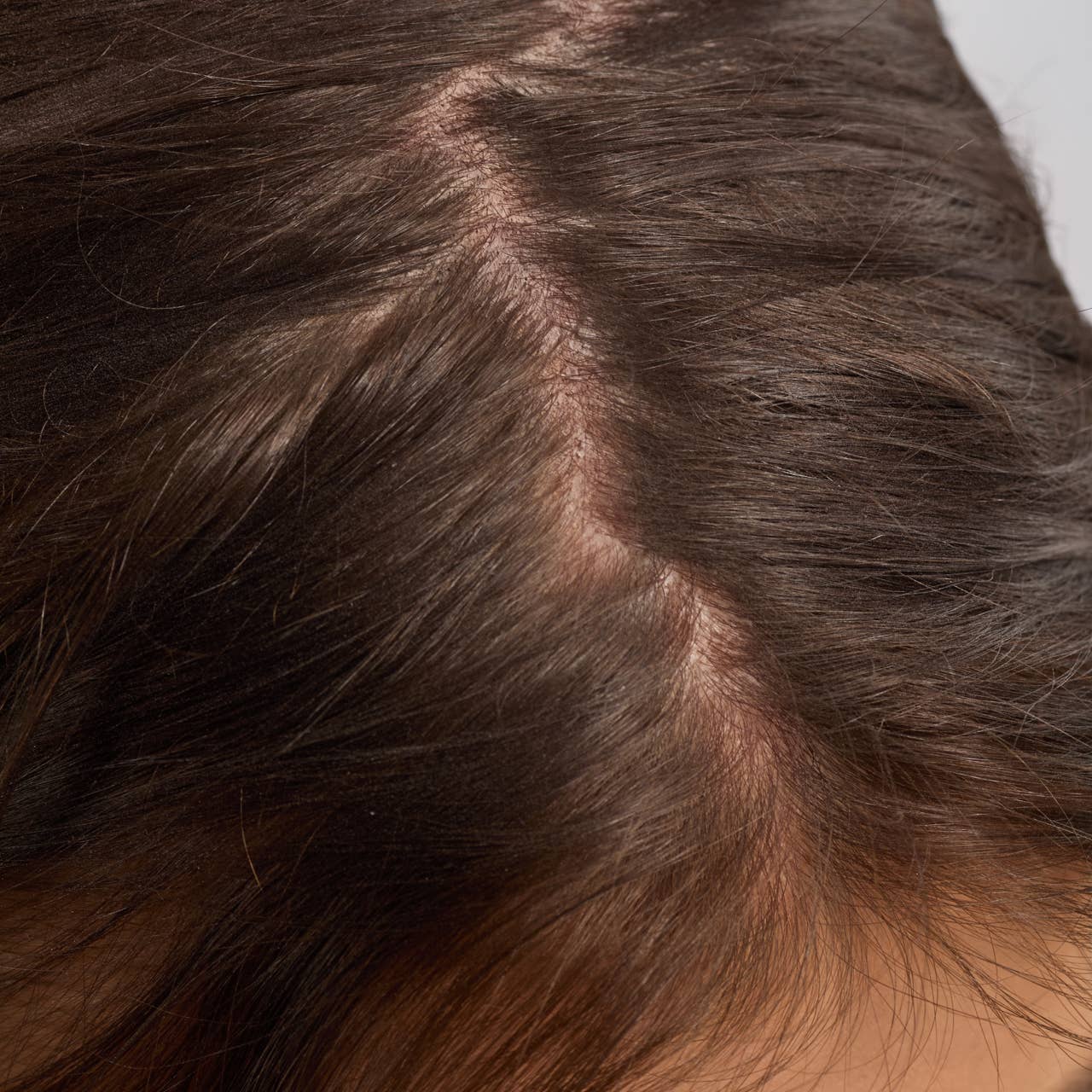KITSCH | Rosmarin Kopfhaut- und Haaröl – nährendes Haar- und Kopfhautöl mit Biotin